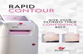 Top 3 máy giảm béo hiệu quả nhất