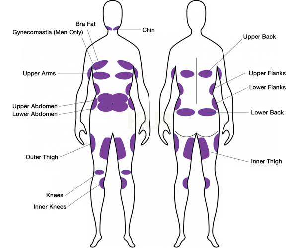 TruSculpt ID ứng dụng điều trị ở nhiều vùng khác nhau trên cơ thể