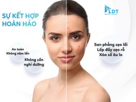 Có bao nhiêu công nghệ điều trị sẹo hiệu quả hiện nay?