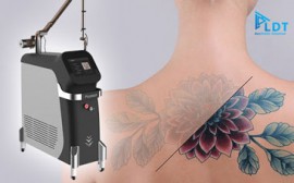 Laser Q switched Picotech - 8 tác dụng trong một siêu phẩm