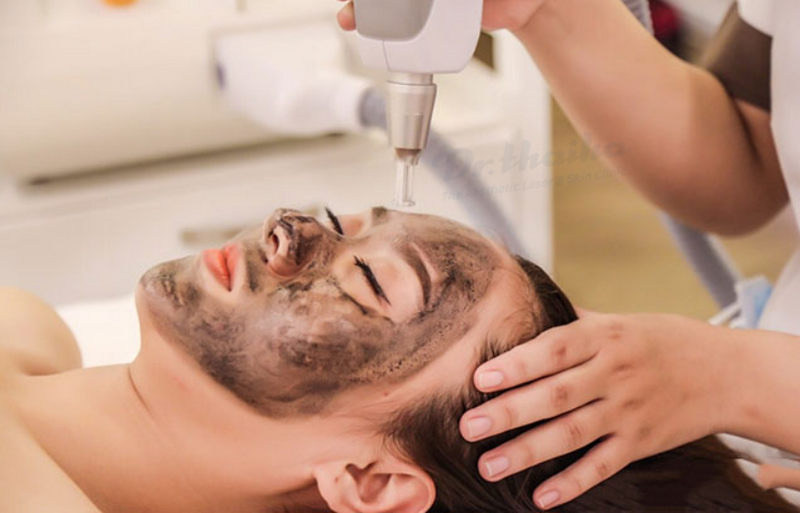 Những cách chăm sóc da sau khi sử dụng máy bắn laser carbon