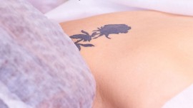 Máy thẩm mỹ tích hợp 2 chức năng Triệt lông và Laser xóa xăm