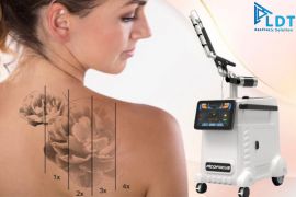 Máy laser xóa xăm tốt nhất 2022 mà bạn nên biết